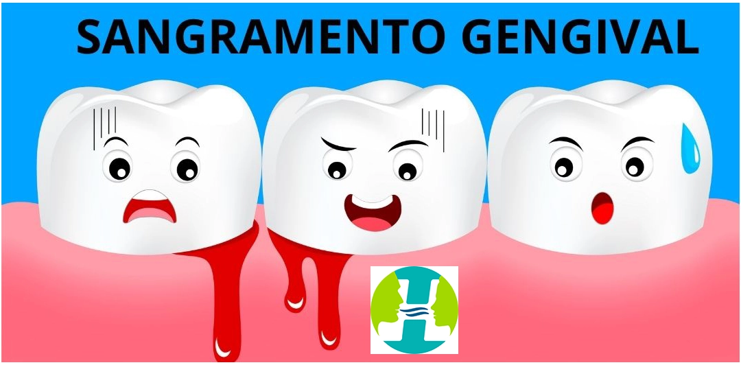 Sangramento Gengival