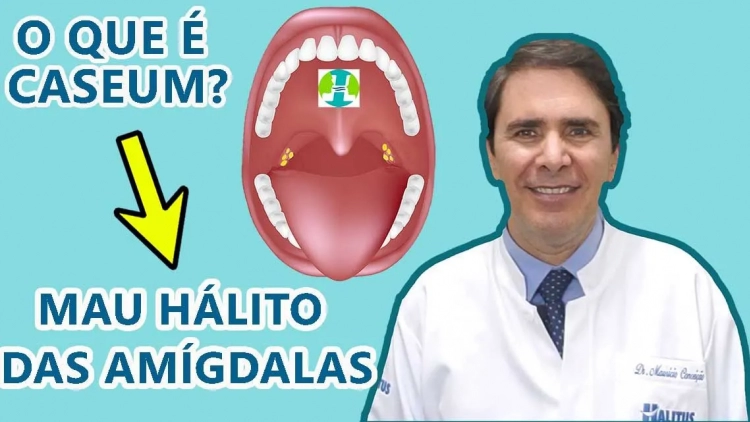 ACABE com as Bolinhas Fedorentas da Garganta e o MAU HÁLITO.